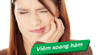 Nguyên nhân và phương pháp điều trị viêm xoang hàm do răng