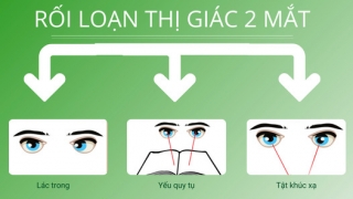 Phát hiện rối loạn thị giác hai mắt như thế nào?