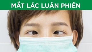 Nguyên nhân, triệu chứng, điều trị mắt lác luân phiên