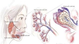 Các dấu hiệu nhận biết sớm ung thư tuyến nước bọt