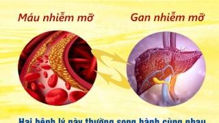 Mỡ máu cao, gan nhiễm mỡ, điều trị như thế nào?