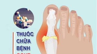 Chia sẻ về một số loại thuốc tây điều trị bệnh gout