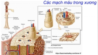 Những điều cần biết về căn bệnh hoại tử xương - Hội chứng hậu COVID-19 hiếm gặp