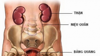 Chuyên gia khuyến cáo những đối tượng cần khám sàng lọc về thận - tiết niệu