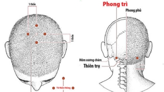 Bấm huyệt Tứ Thần Thông trị đau đầu, căng thẳng