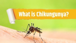 Các triệu chứng của bệnh nhiễm trùng Chikungunya là gì?