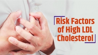 10 yếu tố rủi ro lớn có thể khiến mức cholesterol của bạn tăng đột ngột