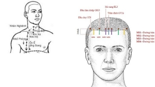 Tác dụng của châm cứu, bấm huyệt Đầu Duy đối với sức khỏe