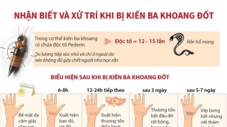 Infographic: Nhận biết và xử trí khi bị kiến ba khoang đốt