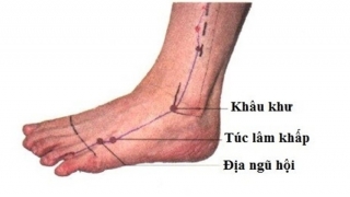 Huyệt Túc Lâm Khấp đóng vai trò quan trọng trong điều trị một số bệnh lý