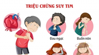 Tầm quan trọng của việc khám sức khỏe tim mạch định kỳ