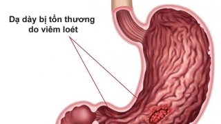 Những bệnh thường gặp sau Tết