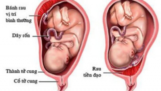 Những điều cần biết về rau tiền đạo