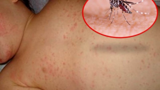 Phú Yên ghi nhận 2 trẻ tử vong do sốt xuất huyết