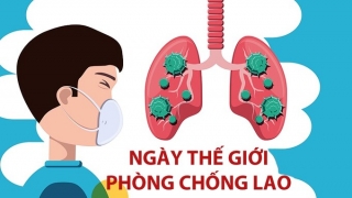 Hà Nội hưởng ứng Ngày Thế giới phòng, chống lao 24/3/2023