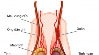 Nghệ An: Một bé trai 11 tuổi mắc chứng xoắn tinh hoàn phải mổ cấp cứu