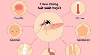 Những điều cần biết về sốt xuất huyết