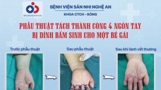 Nghệ An phẫu thuật tách 4 ngón tay dính bẩm sinh cho 1 bệnh nhi