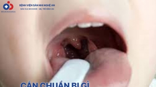 Cần chuẩn bị gì trước khi cắt amidan?