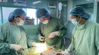 Quảng Bình phẫu thuật thành công khối u buồng trứng dạng u quái, chứa đầy tóc và da cho cô gái 18 tuổi