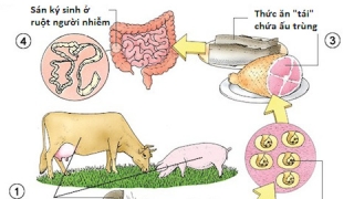 Sở Y tế tỉnh Ninh Bình ban hành kế hoạch phòng chống bệnh ký sinh trùng giai đoạn 2023-2025