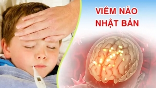 Phú Thọ: Bệnh viện Đa khoa Hùng Vương điều trị cho bé trai 7 tuổi bị viêm não Nhật Bản với di chứng nặng nề do đến viện muộn