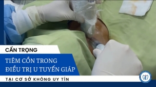 Bệnh viện Nội tiết Trung ương tiếp nhận 1 bệnh nhân tiêm cồn trong thời gian dài tại một cơ sở tư nhân dẫn đến xơ hóa vùng cổ