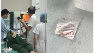 Hà Nội: Bệnh viện Hữu Nghị phẫu thuật gắp thành công một dị vật là 1 viên thuốc cả vỏ sắc nhọn ra khỏi thực quản của bệnh nhân