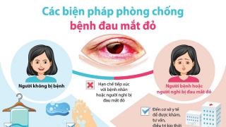 Cà Mau tăng cường phòng, chống bệnh đau mắt đỏ