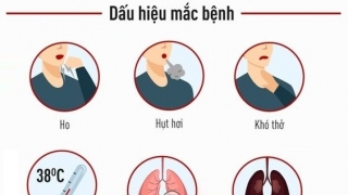 Những điều cần biết về viêm phổi cộng đồng