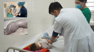 Nghệ An: Gia tăng tình trạng trẻ bị lồng ruột do thời tiết chuyển lạnh