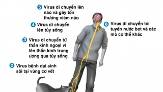 Bệnh dại nguy hiểm ra sao?