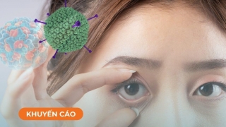 Virus Adeno: Nguyên nhân số 1 gây ra dịch đau mắt đỏ trong giai đoạn cuối mùa xuân