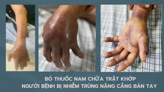 Phú Thọ: Tự ý bó thuốc nam khi bị trật khớp tay, cụ ông bị nhiễm trùng nặng