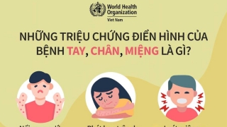 Khuyến cáo cách phòng tránh bệnh tay chân miệng