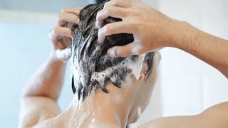 Triệu chứng, nguyên nhân và cách điều trị bệnh vẩy nến da đầu