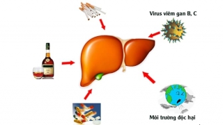 Vì sao nóng gan ngày càng nhiều và các món ăn bổ gan là gì?