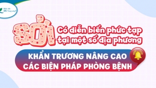 Khẩn trương nâng cao các biện pháp phòng dịch bệnh sởi