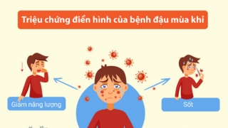 Hà Nội tăng cường phòng, chống bệnh Đậu mùa khỉ