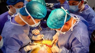 Quảng Ninh: Ghép thận thành công cho hai bệnh nhân ngay trong đêm