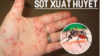 Hà Nội: Chủ động các biện pháp phòng, chống sốt xuất huyết