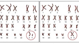Cân bằng giới tính sinh học của thai nhi có quan trọng hay không?