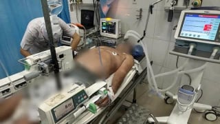 Vĩnh Long: Hơn 60 phút ép tim, giành lại sự sống cho bệnh nhân nhồi máu cơ tim