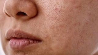 Tuyệt chiêu giữ da khỏe đẹp trong mùa du lịch
