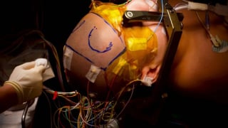 Thái Lan phẫu thuật thành công cho người mắc hội chứng Tourette
