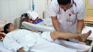 Khuyến cáo về suy giãn tĩnh mạch chân ở nữ giới