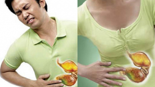 Người bị viêm loét dạ dày kiêng ăn gì