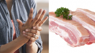 Bệnh gút ăn thịt heo được không?
