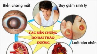 Chỉ số đường huyết sau ăn bao nhiêu là bình thường?