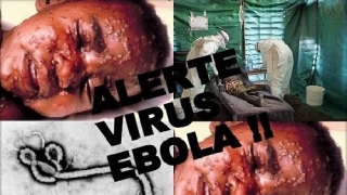 Thời gian ủ bệnh ebola bao lâu?